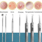 8pcs Ultra-fine Beauty Salon Acne Needle Tool Set